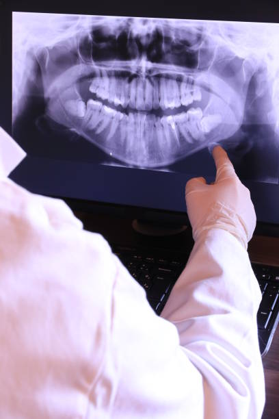 Best Dental Abscess Treatment in Glen Lyon, PA