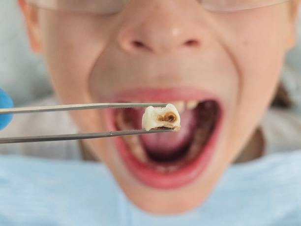 Best Weekend Emergency Dental Services in Glen Lyon, PA